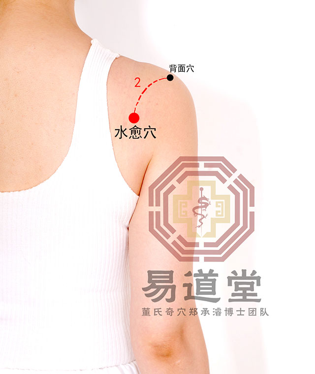 说明 1,水愈穴位置与小肠经之俞相符,治述各症确有卓效