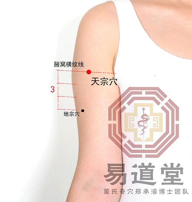 天宗穴_四四部位(后臂部)_2018年第五届董氏奇穴针灸