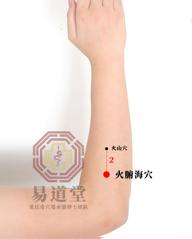 火腑海穴
