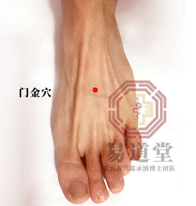 门金穴