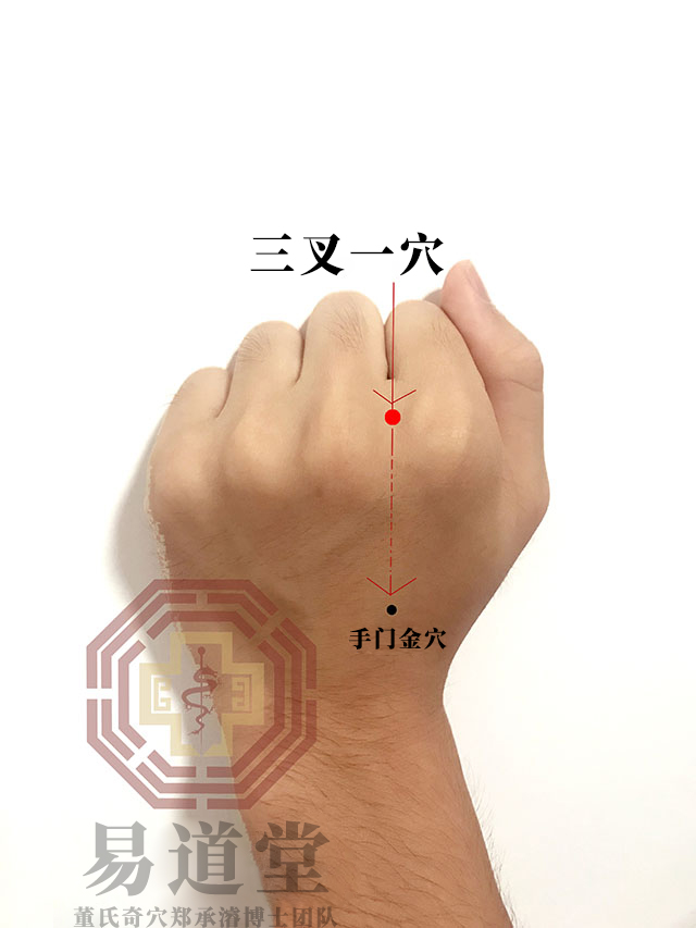 三叉一穴
